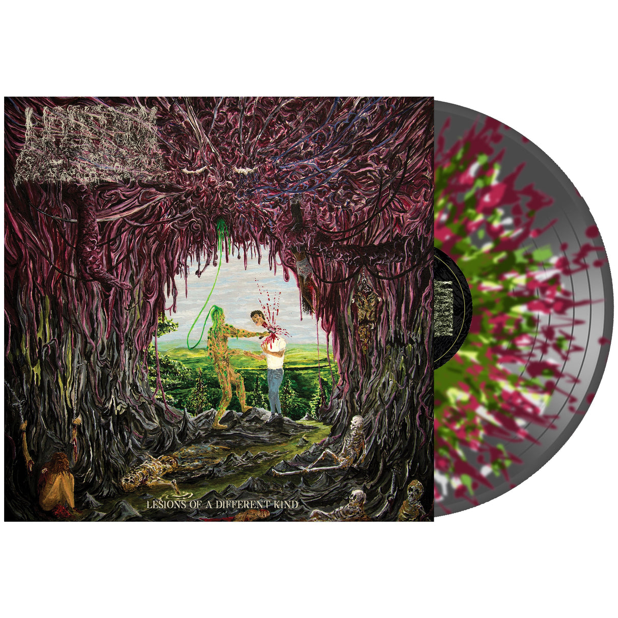 Undeath - Lesions of A Different Kind on Vinyl