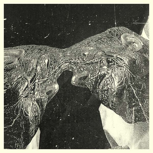 Memory Care Unit (Vinyl) - Apocalypse Vinyl