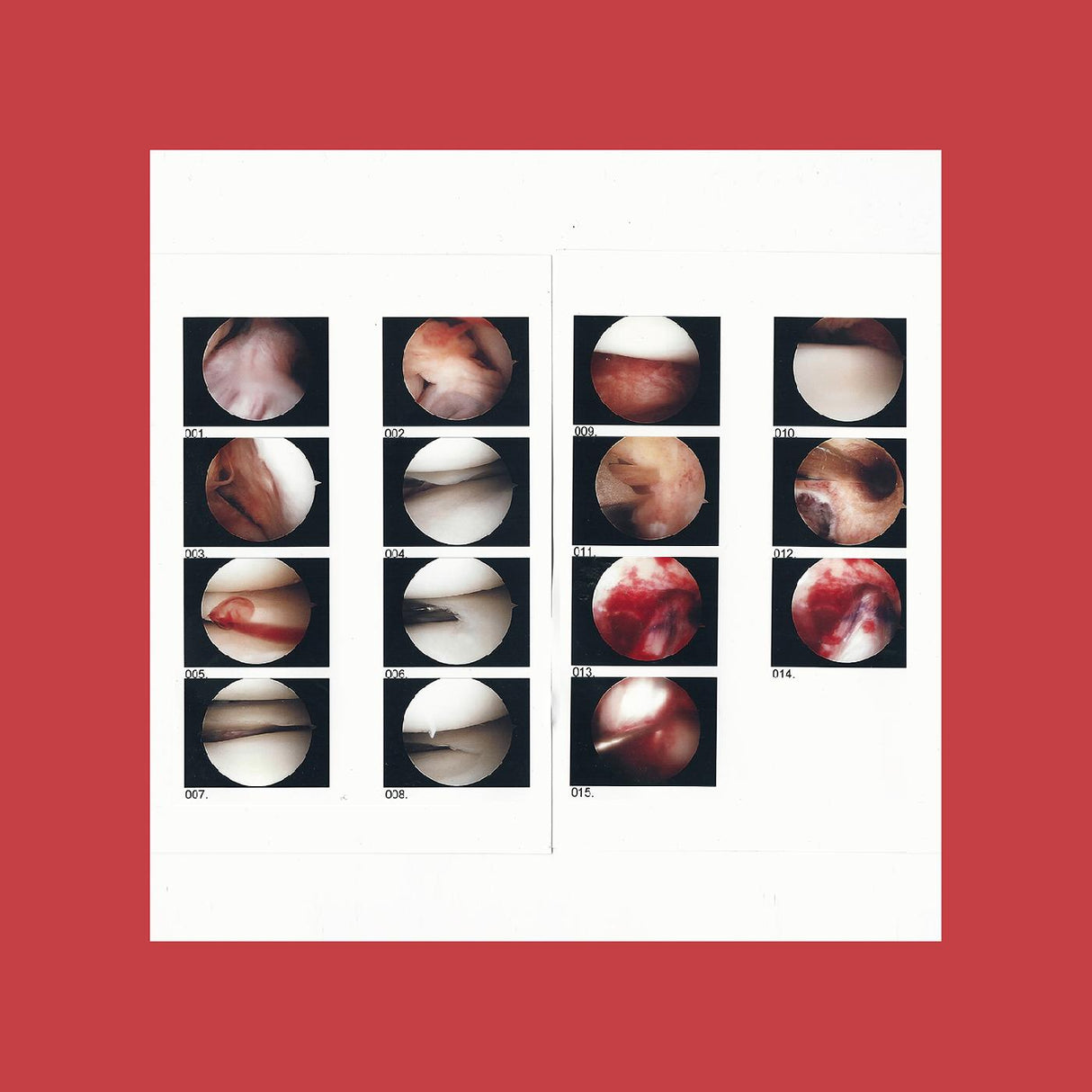Laughing In My Sleep (Vinyl) - Apocalypse Vinyl