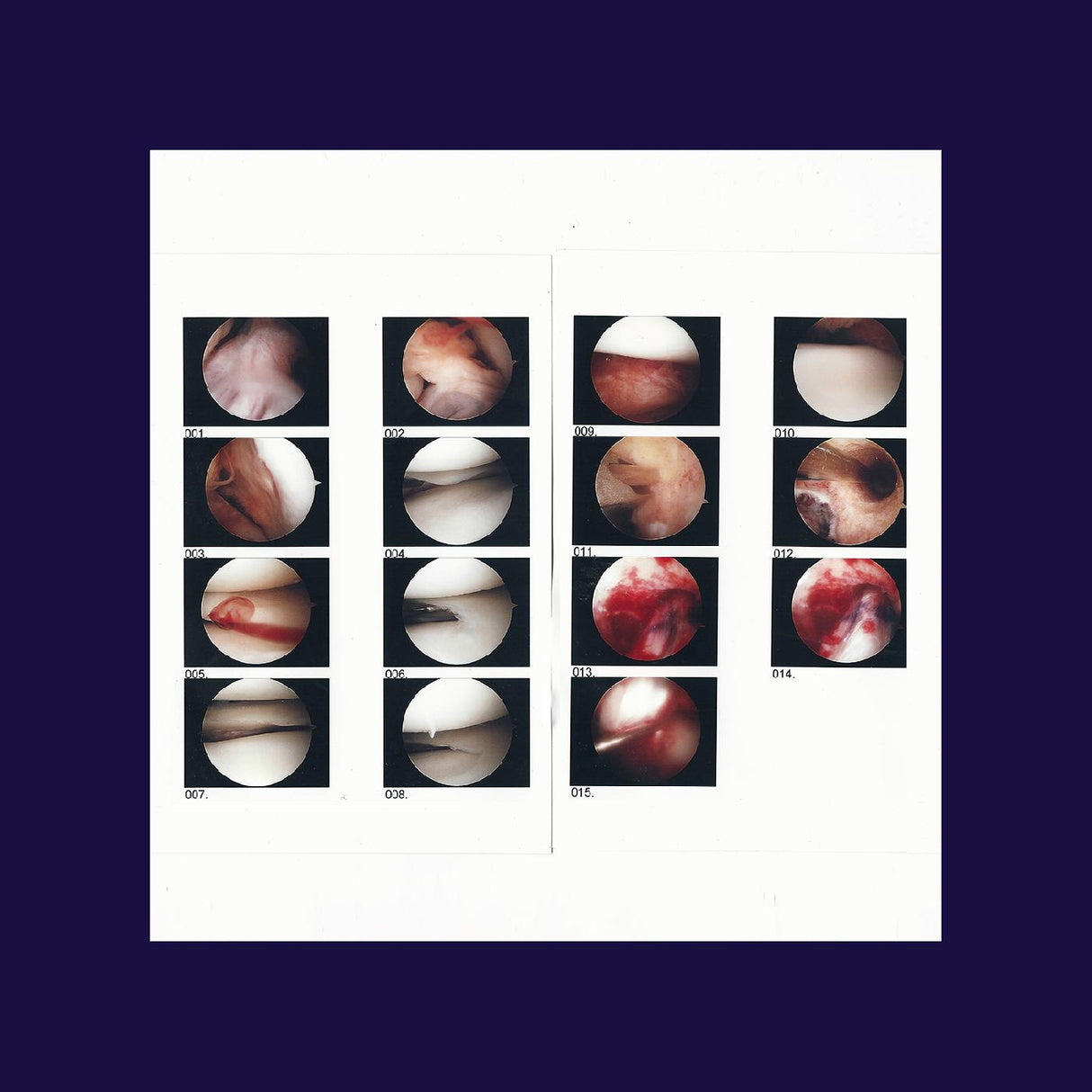 Laughing In My Sleep (CD)