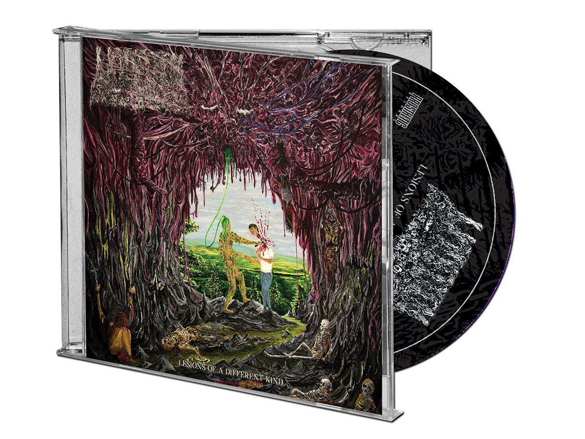 Undeath - Lesions of a Different Kind CD