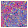 Placenta [CD]