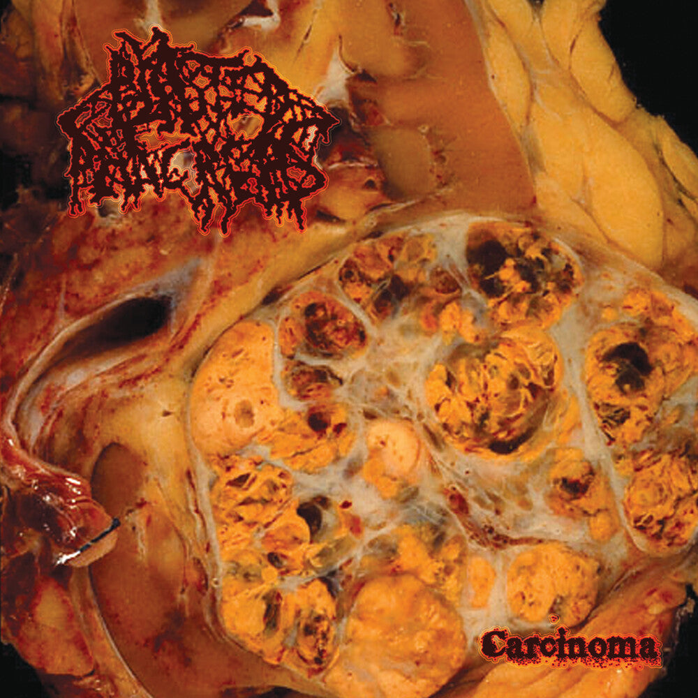the album cover for Blasted Pancreas - Carcinoma [Colored Vinyl] [Limited Edition] (Red)
