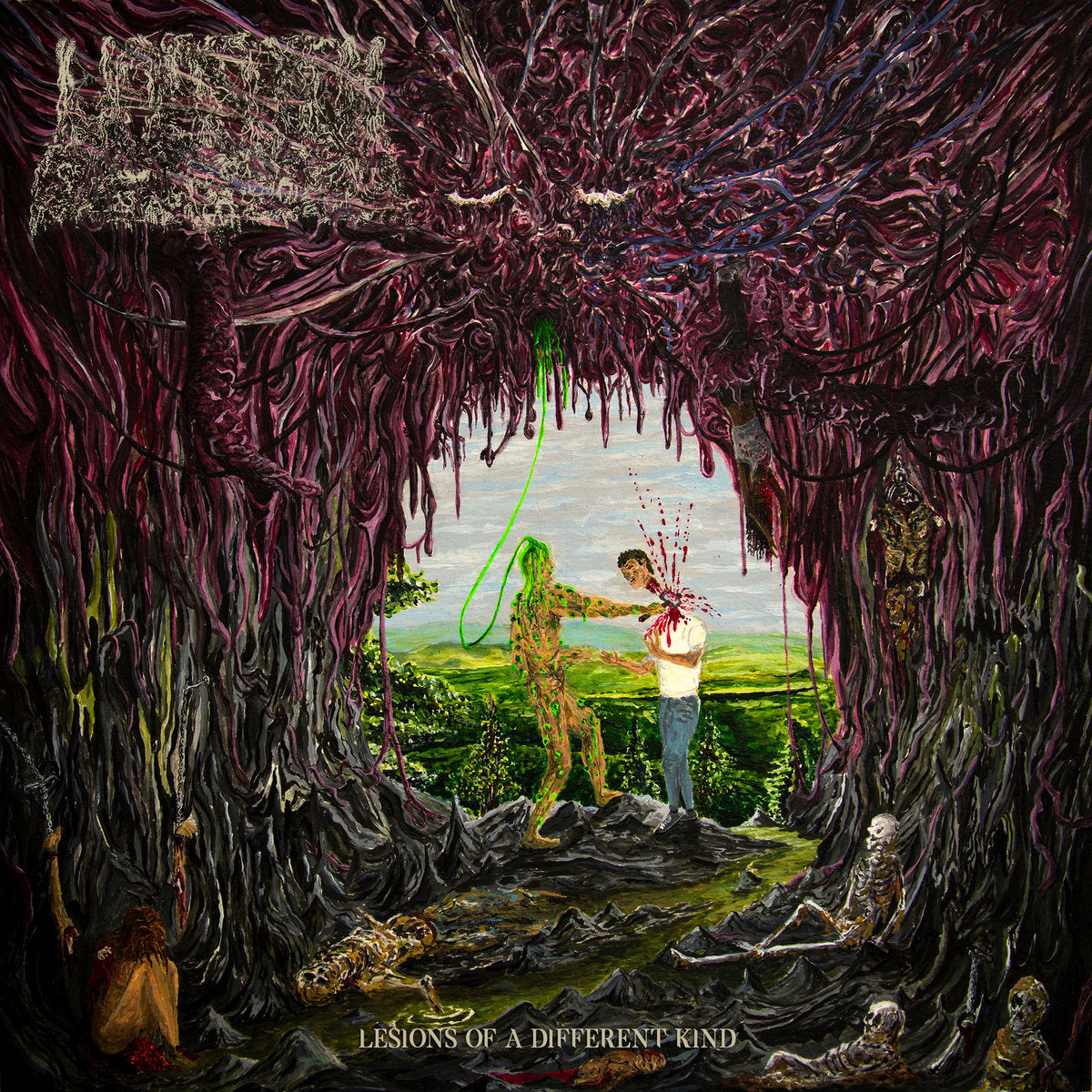 Undeath - Lesions of a Different Kind CD