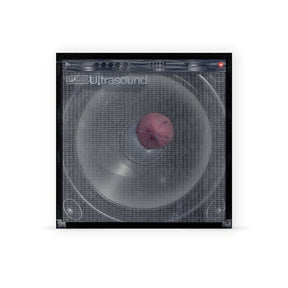((((((Ultrasound)))))+ (Indie Exclusive) [Mauve Vinyl] [2LP] [Vinyl]